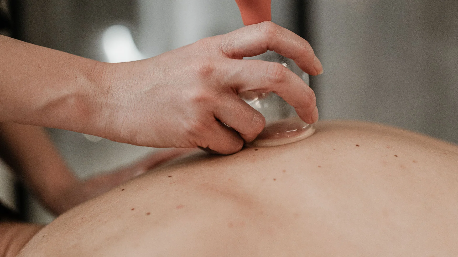 Trattamenti e massaggi in Trentino Mano che applica una ventosa per massaggi sulla schiena nuda di una persona